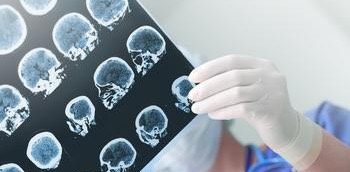 Doctora con una ecografía cerebral