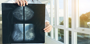 Radiografía para detectar cáncer de mama