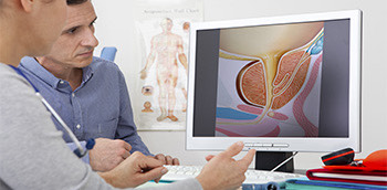 Médicos observando imagen de la próstata