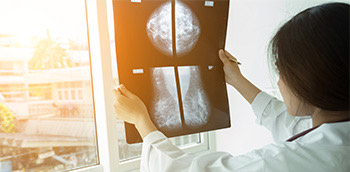 Doctora mirando una Radiografía para detectar cáncer de mama
