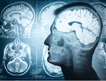 Radiografía del cerebro para psiquiatría