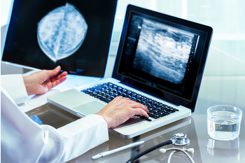 Doctor revisando una radiografía con cáncer mamario