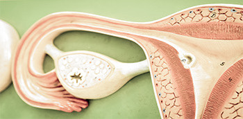 Imagen de unos ovarios con miomas