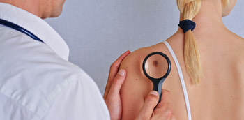 Dermátologo observando mancha en la piel de la espalda de una paciente